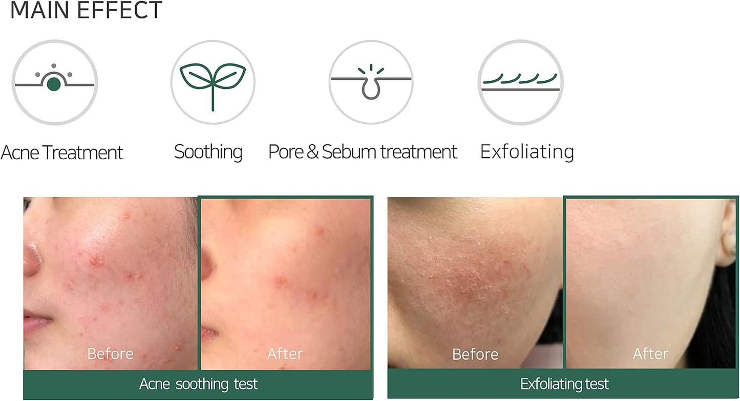 SOME BY MI Aha Bha Pha 30 Days Miracle Acne Clear Foam