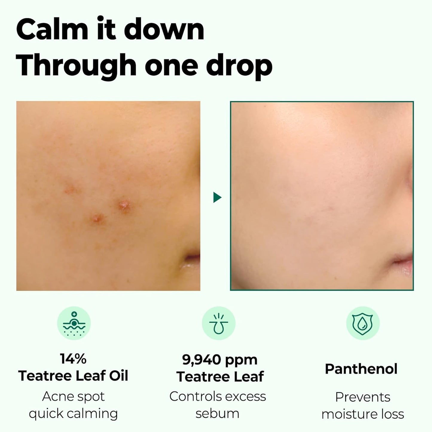 SOME BY MI 30 Days Miracle Tea Tree Clear Spot Oil