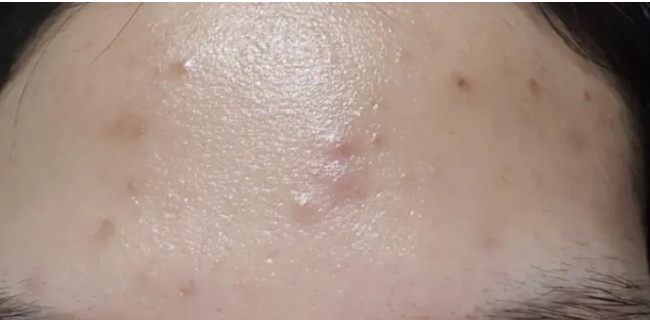 Before Image